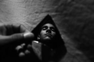 脱毛後に肌バリアが壊れやすい原因とは？